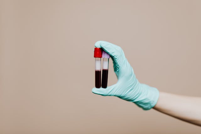Gut Health Testing vs. Basic Bloodwork: Why Standard Labs Miss What's Actually Wrong