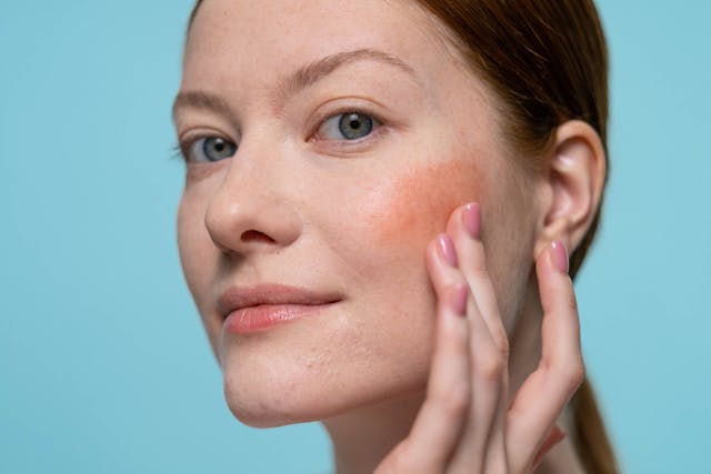 The Gut-Skin Connection: Why Clearing Your Skin Starts in Your Digestive System