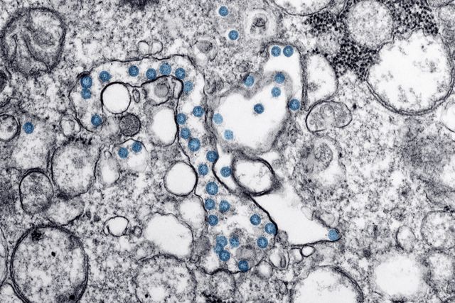 The Complete Guide to Gut Health Testing