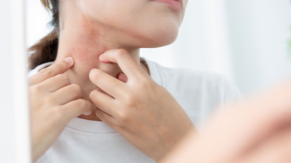 How Liver Health Shapes Your Skin: The Functional Beauty Guide to Clear, Radiant Skin